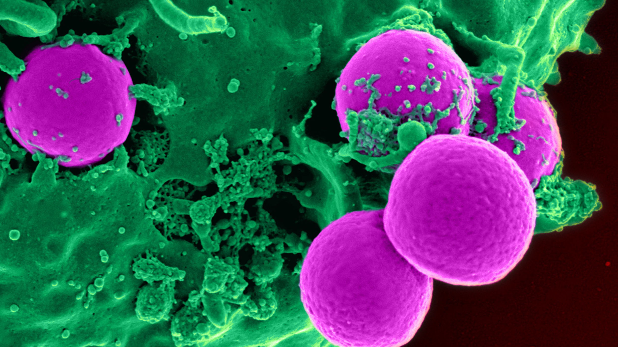 image of purple and green bacteria
